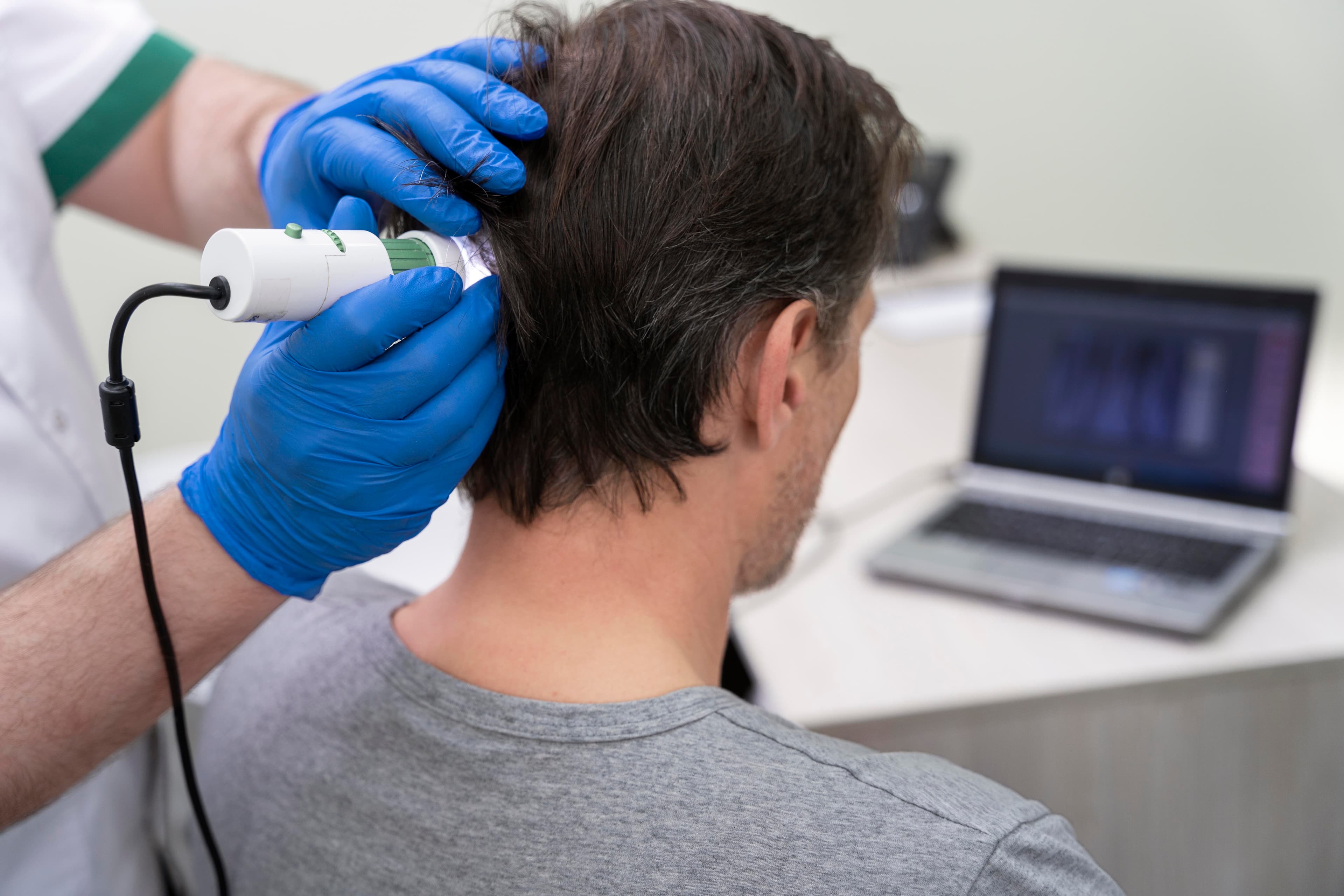 Hair Restoration Consultation